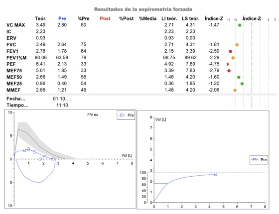 Espirometría 3