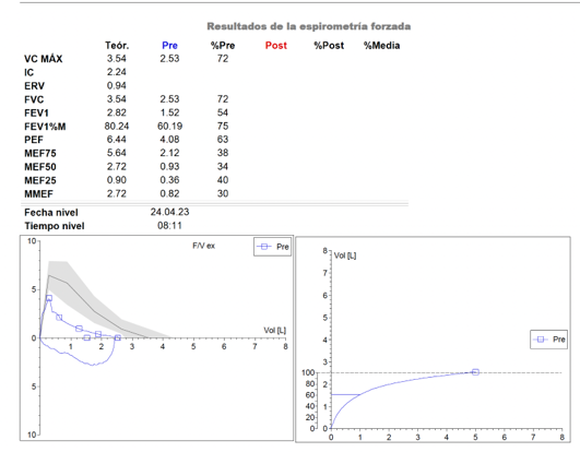 Espirometría POSBD