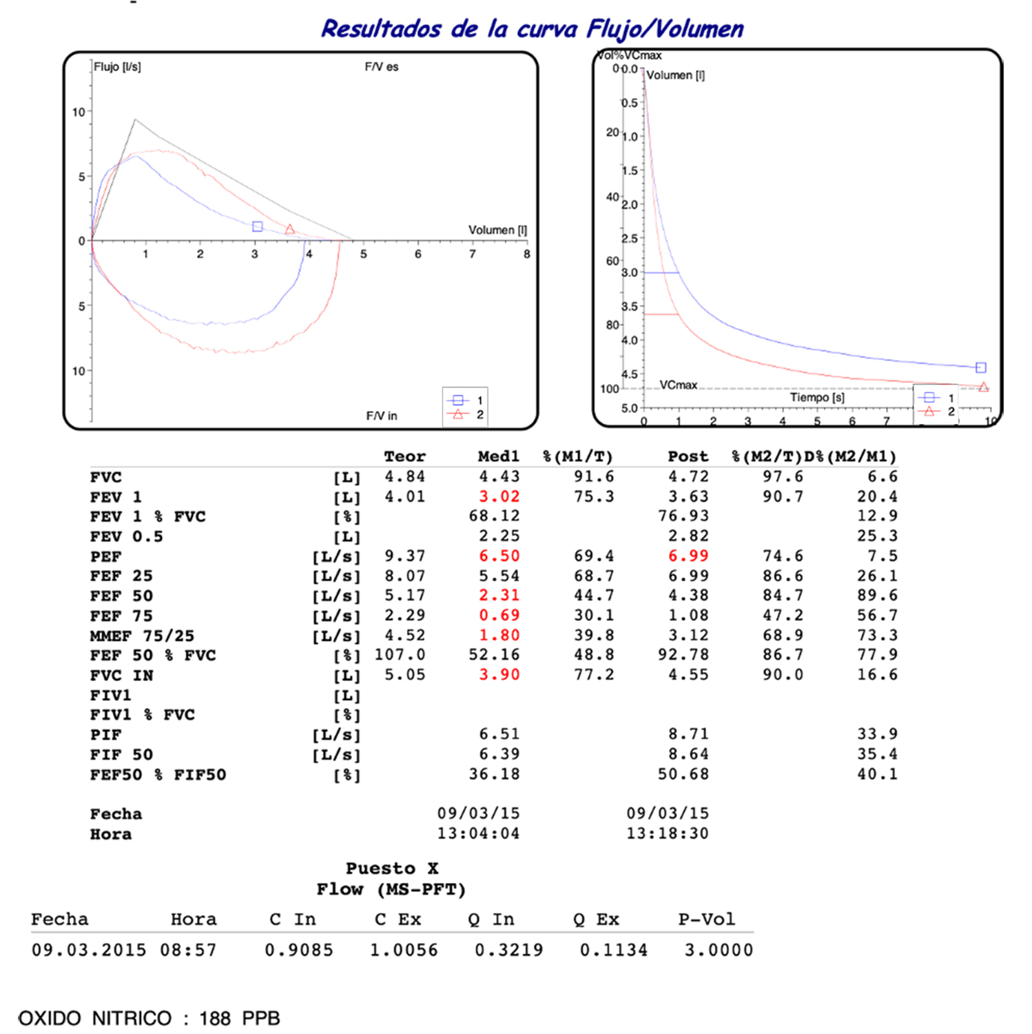 Resultados de la curva Flujo/Volumen