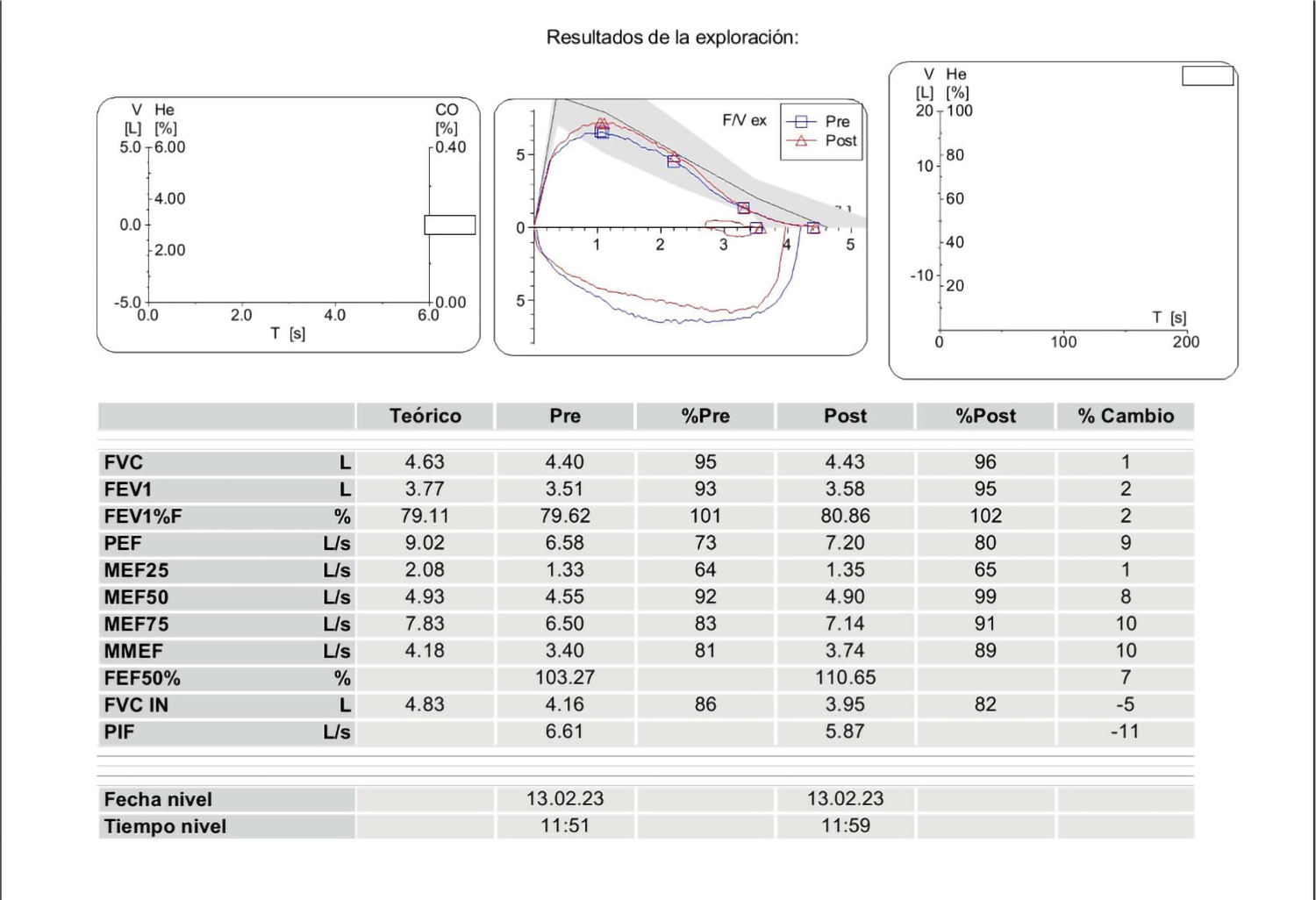 Resultados de la curva Flujo/Volumen 3
